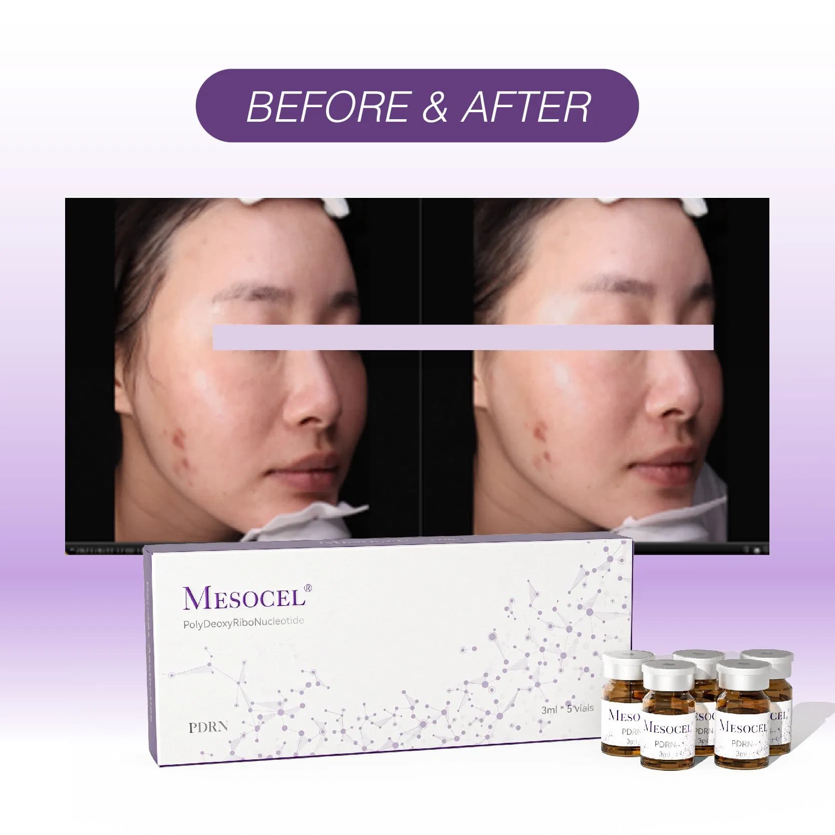 Mesocel Glow Skin Rejuvenating Solution Pdrn Salmon DNA Skin Rejuvenation Serum
