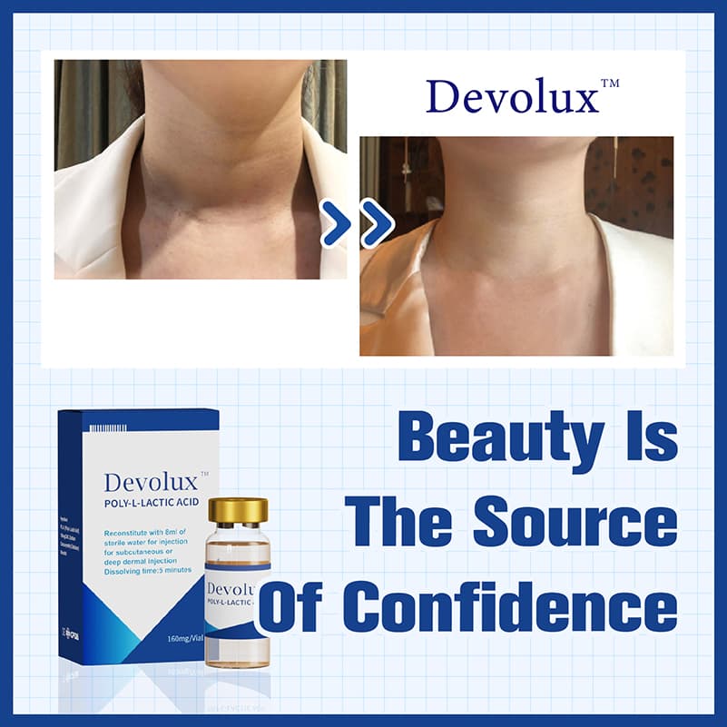 Wholesale Devolux Plla Filler Poly-L-Lactic Acid Vials Poly L Lactic Acid Demal Filler Anti-Aging